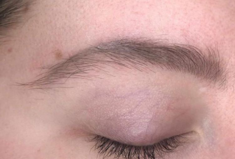 Eyebrows Before
